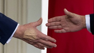 Trump padece insuficiencia venosa crónica