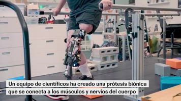Esta tecnología biónica permite a amputados volver a moverse gracias a un implante en el fémur