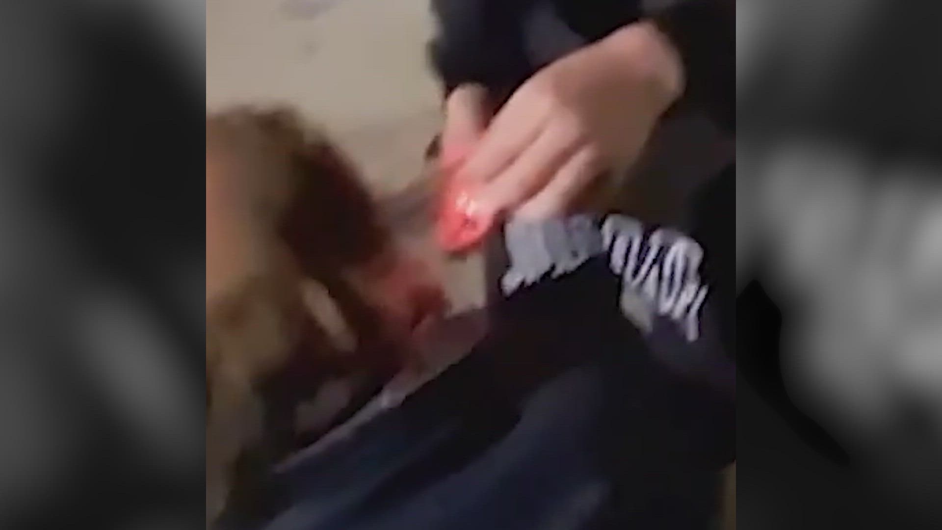 Menores queman el pelo de un hombre sin hogar