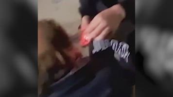 Menores queman el pelo de un hombre sin hogar